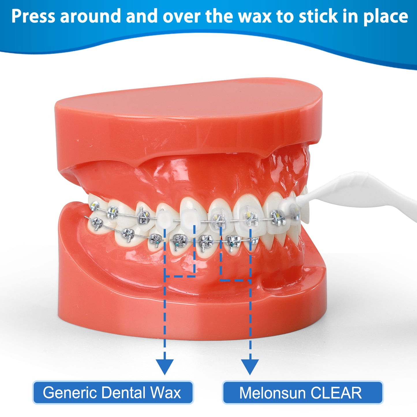 Braces Wax, Unscented/Mint +Aloe Vera +Vitamin E